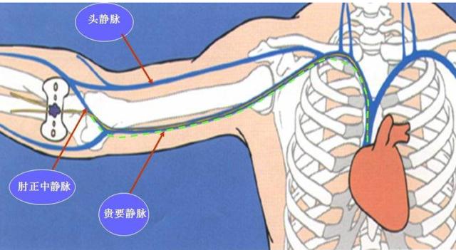 高龄老人PICC置管后营养、输液更方便！网约护理让延续护理进家门