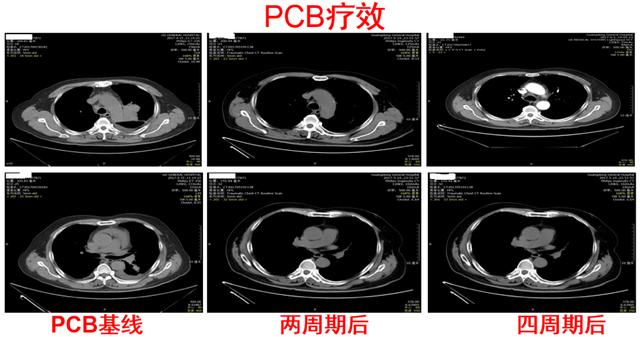 肿瘤治疗的空窗期应该如何用药？