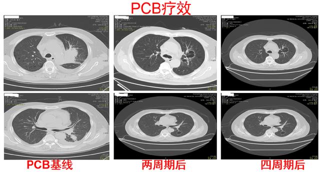 肿瘤治疗的空窗期应该如何用药？