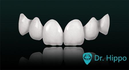 牙齿修复材料怎么选？